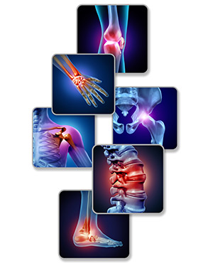 Physical Therapy for ABC Medical Practice in Los Altos, CA